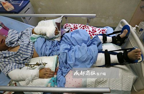 四川：饲养员遭大熊猫疯狂撕咬 脚筋腕骨被咬断(图)